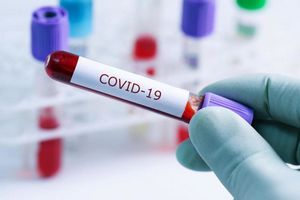 Количество выявленных случаев заболевания коронавирусной инфекцией в области растёт